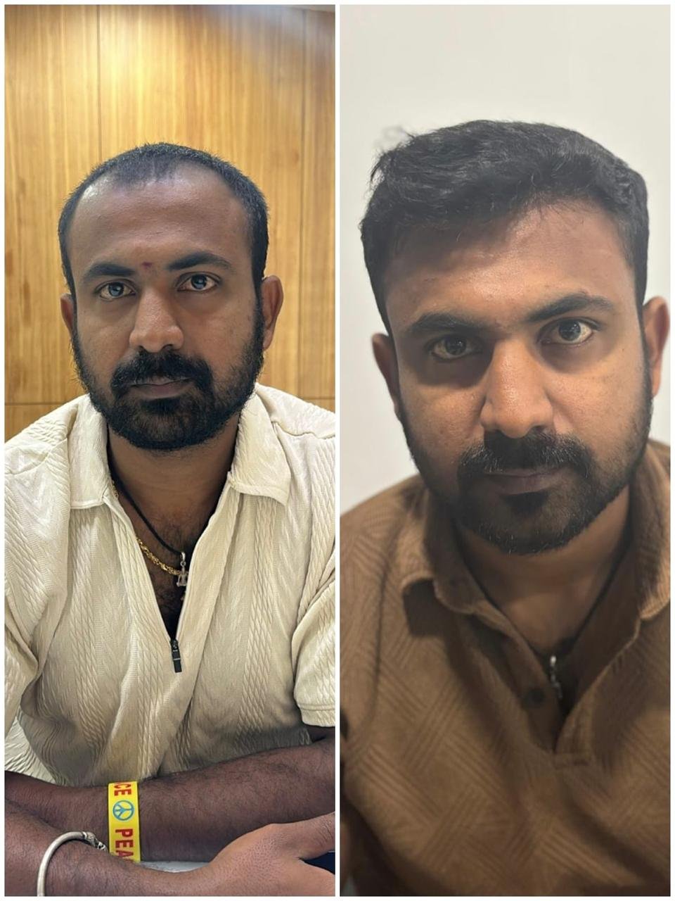 Hair transplant result at Reborn Healthcare