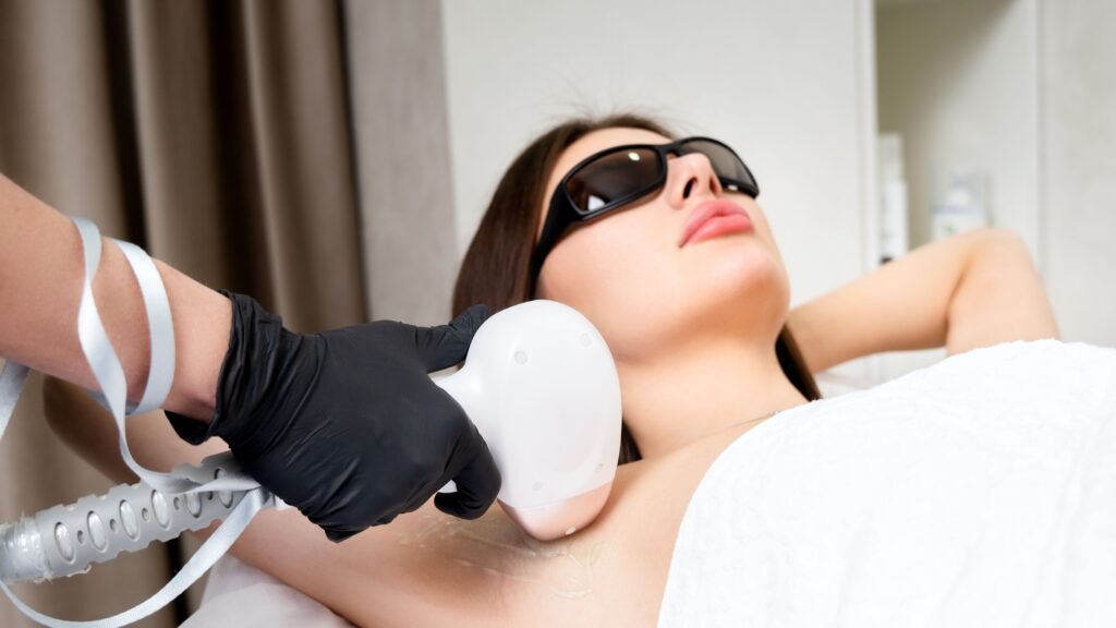 laser hair removal
